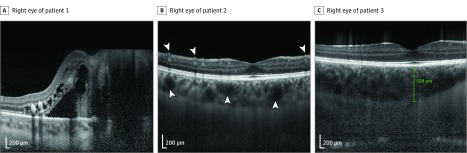 Figure 2. 