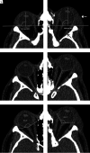 FIG 2.