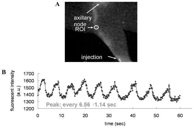 FIGURE 11