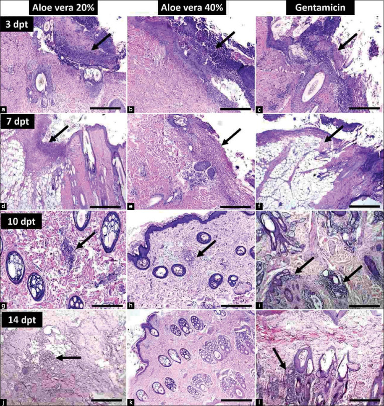Figure-5