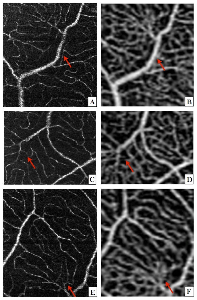 Fig. 10