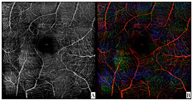 Fig. 9