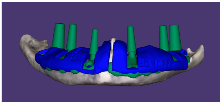 Figure 4