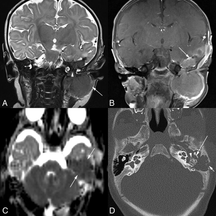 Fig 3.