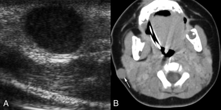 Fig 2.