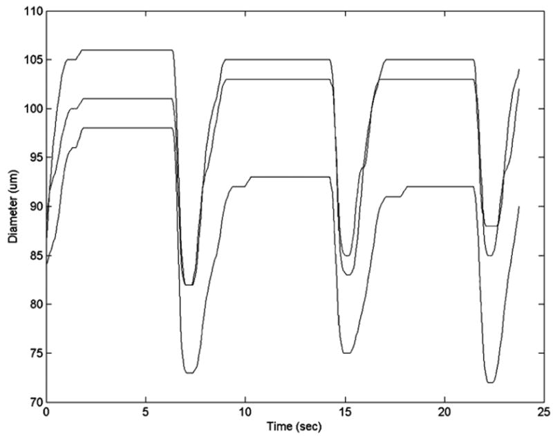 FIGURE 11