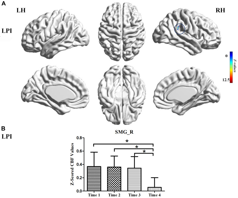 FIGURE 3