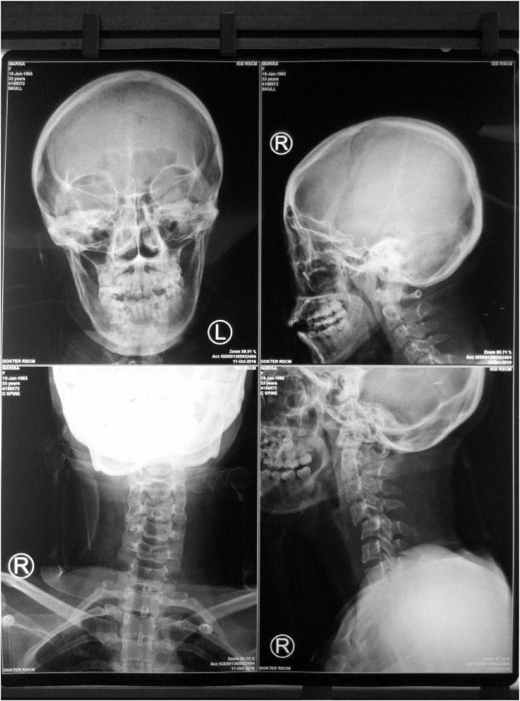 Fig. 2