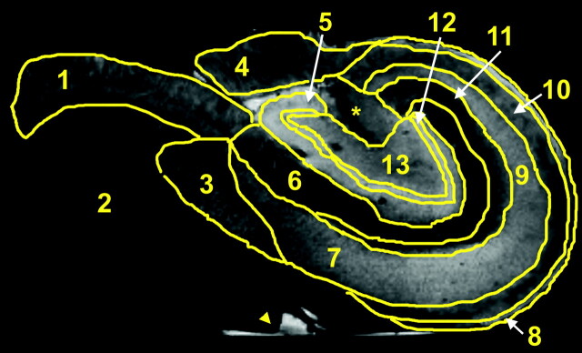 Fig 2.