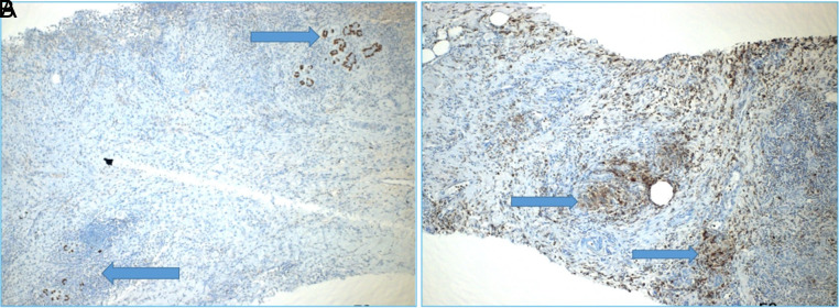 Figure 6. A,B.