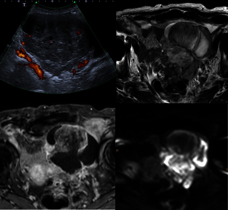 Fig. 2