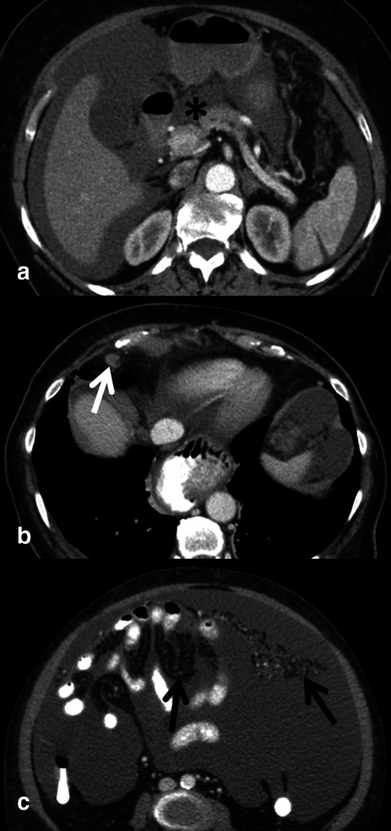 Fig. 3