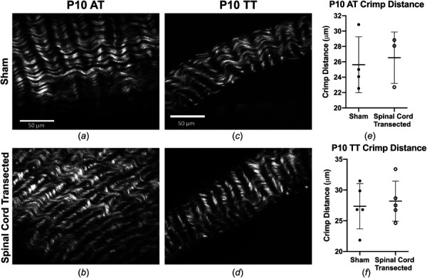 SHG images of collagen in neonatal tendons. Representative SHG images of collagen structure in ATs of (a) sham and (b) spinal cord transected rats, and in TTs of (c) sham and (d) spinal cord transected rats. No differences were detected in (e) and (f) crimp distance between sham and spinal cord transected conditions in ATs or TTs. Scale bar = 50 μm. Bars represent mean±standard deviation.