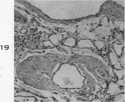 Fig. 19