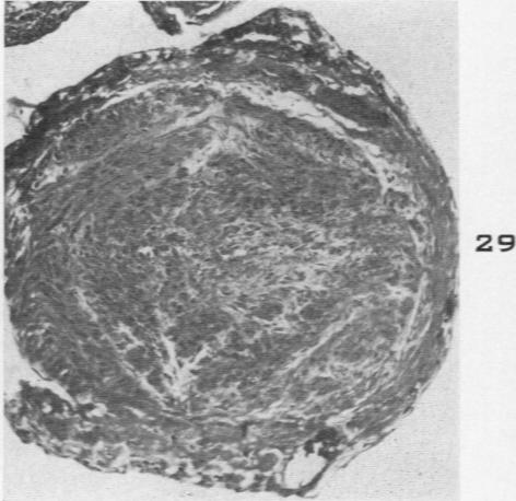 Fig. 29