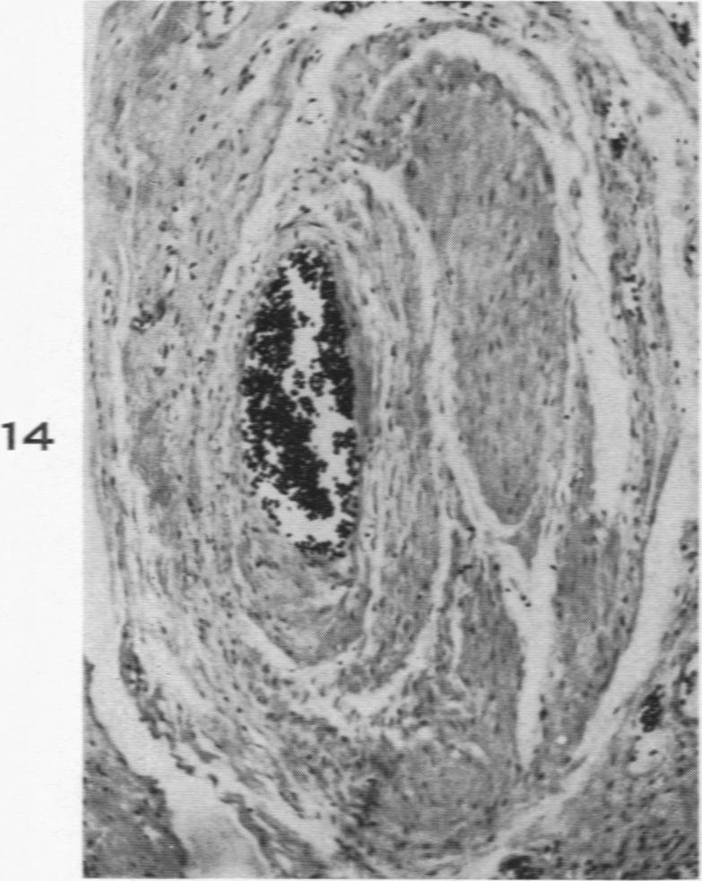 Fig. 14