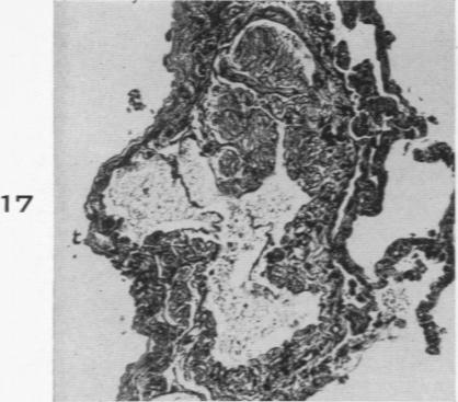 Fig. 17