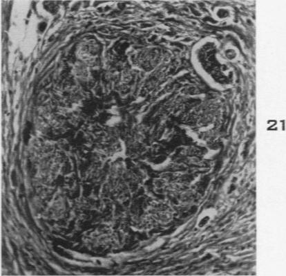 Fig. 21