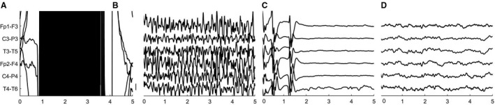 FIGURE 3