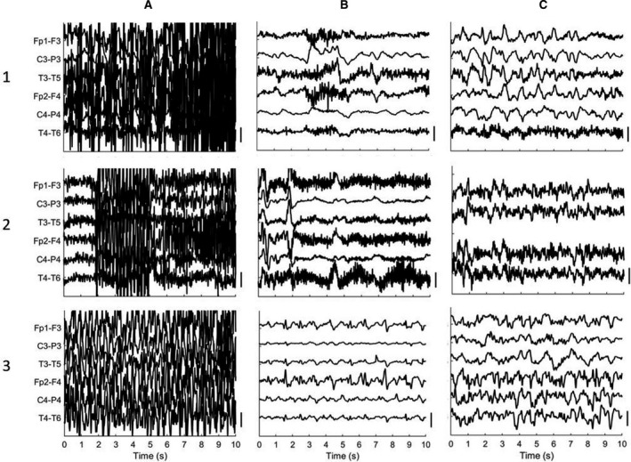 FIGURE 2