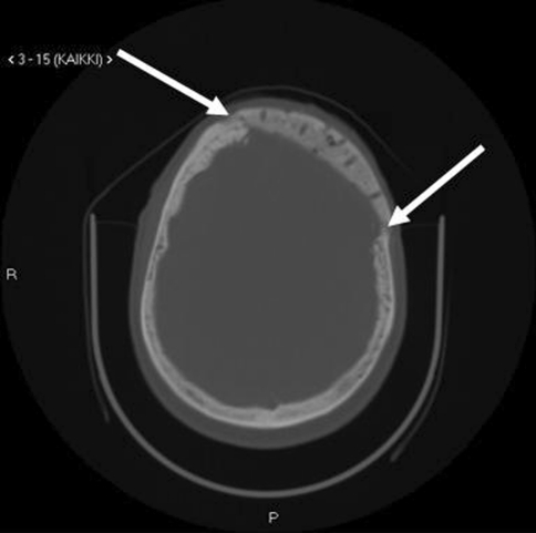 Fig. 5