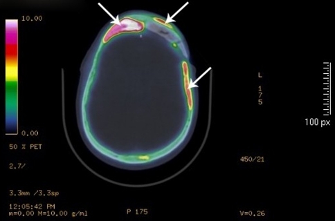 Fig. 6