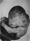 255