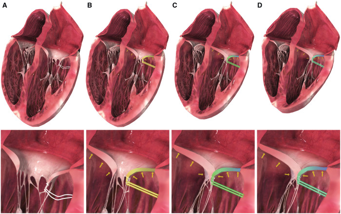 Figure 1: