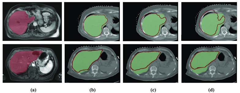 Fig. 4