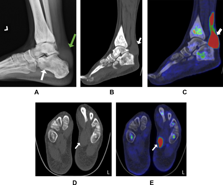 Fig 1