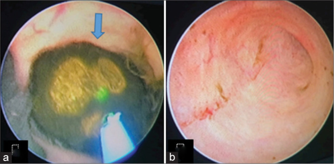 Figure 3: