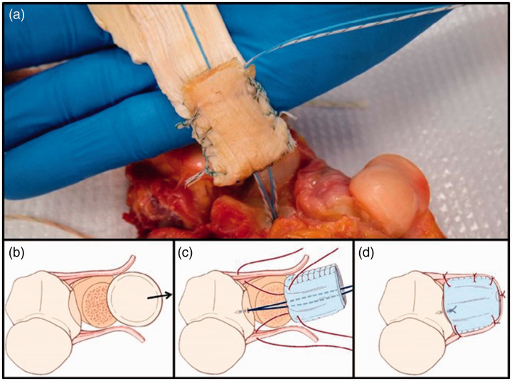 Figure 3.