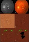 Fig 4