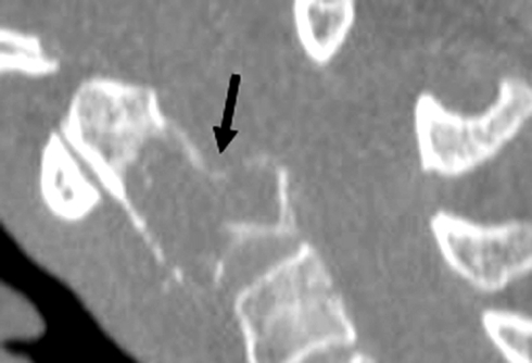 Fig. 1