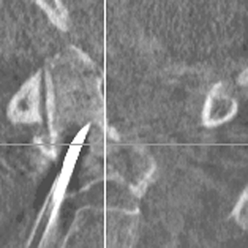 Fig. 6