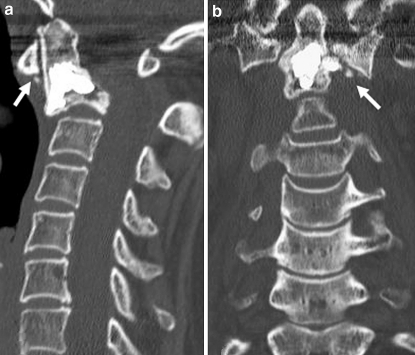 Fig. 9