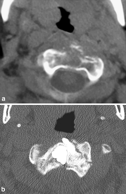 Fig. 10
