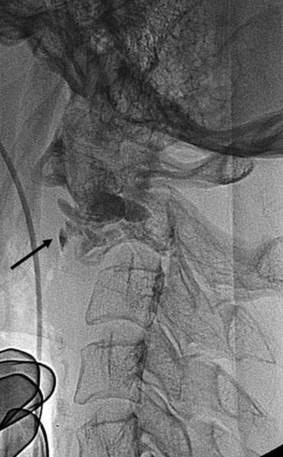 Fig. 7