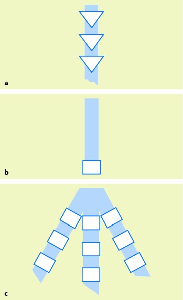 graphic file with name 978-3-642-33108-4_1_Fig14_HTML.jpg