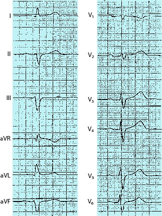 graphic file with name 978-3-642-33108-4_1_Fig92_HTML.jpg