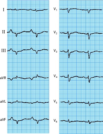 graphic file with name 978-3-642-33108-4_1_Fig98_HTML.jpg