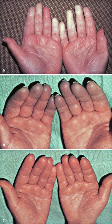 graphic file with name 978-3-642-33108-4_1_Fig13_HTML.jpg