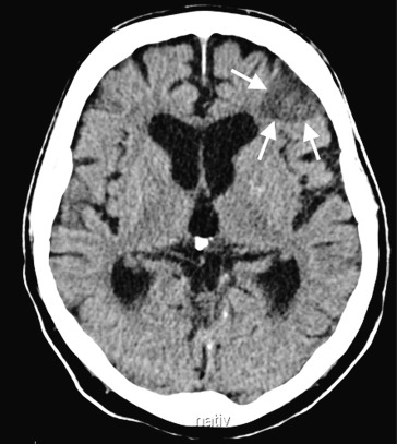 graphic file with name 978-3-642-33108-4_1_Fig23_HTML.jpg