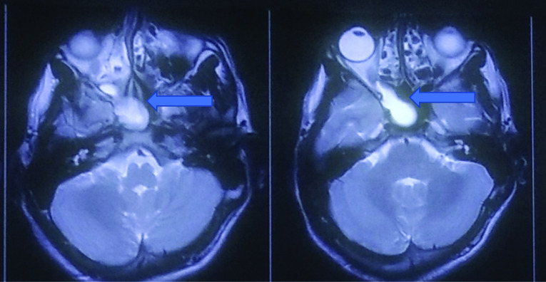 Fig. 2