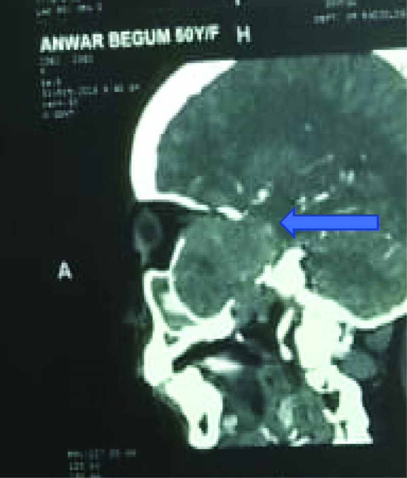 Fig. 3