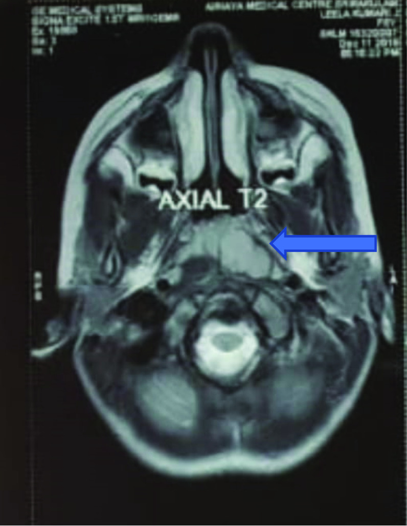 Fig. 4