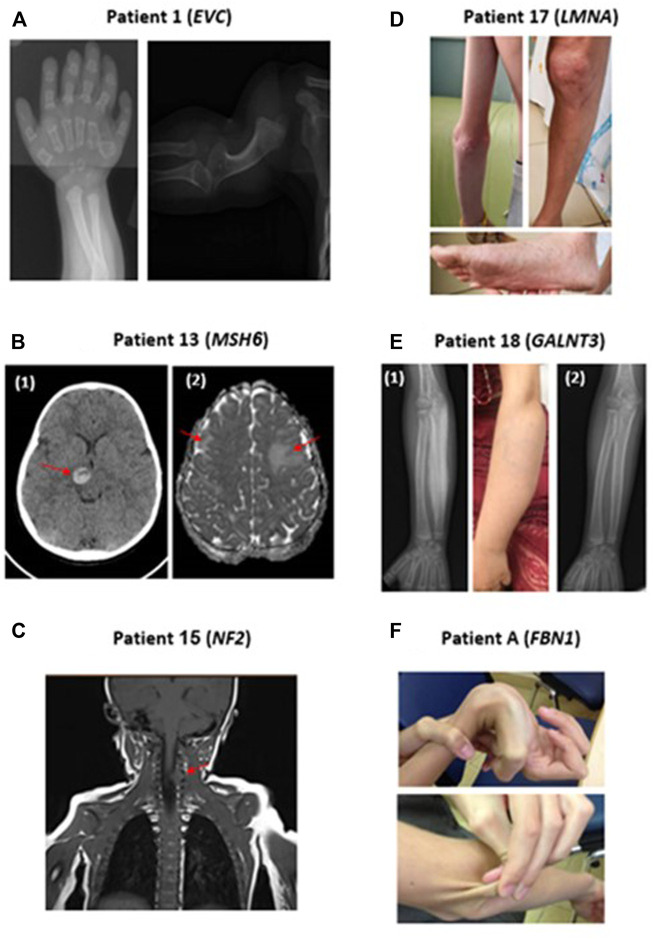 FIGURE 1