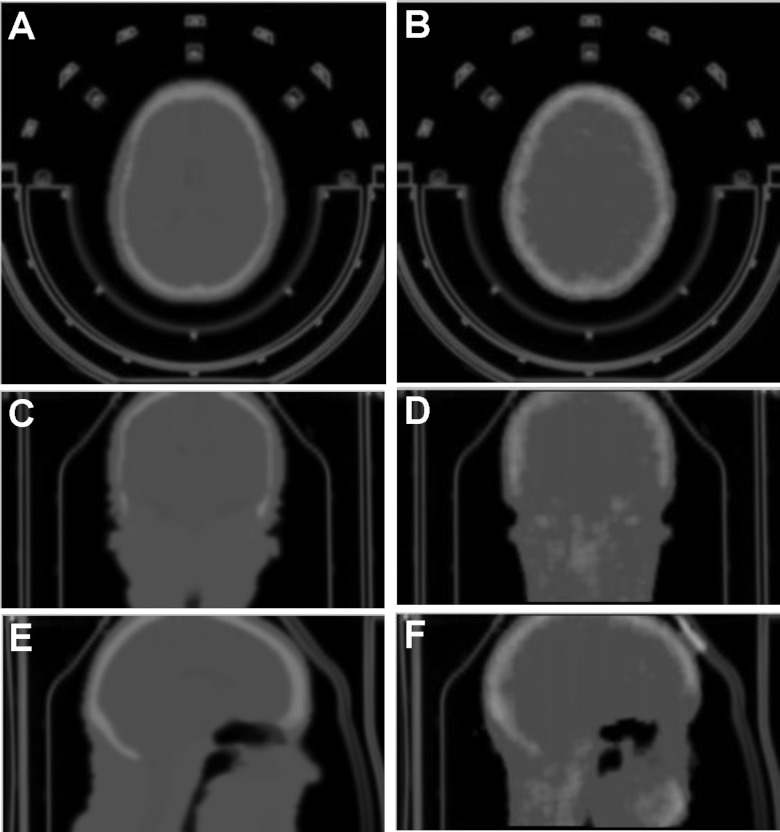 Figure 12