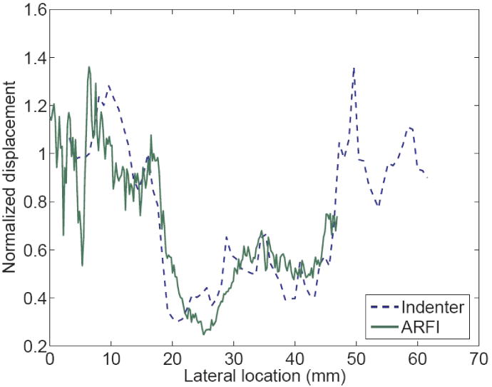 FIG. 11