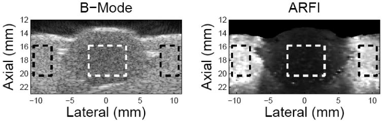 FIG. 8